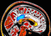 Mindfulness meditation training can ease pain mindfulness and pain