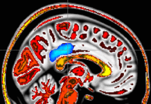 Mindfulness meditation training can ease pain mindfulness and pain