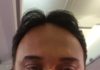 30 bleeding passengers from Jet Airways pilot error Satish Nayer bleeding on Jet Airways